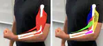 PerSiVal: On-Body AR Visualization of Biomechanical Arm Simulations